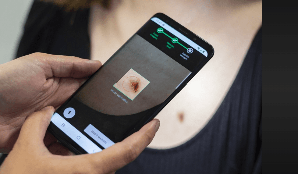 Skin Cancer Detection
